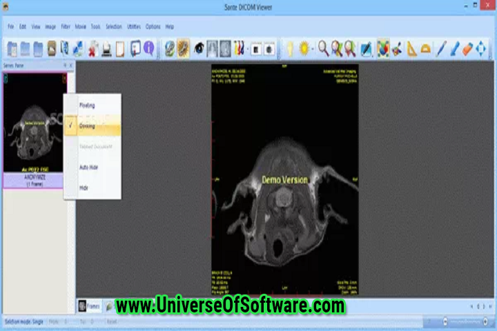 Sante DICOM Viewer Pro 11.9.4 With Patch